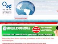 Tratament psoriazis - www.psoremiss.ro